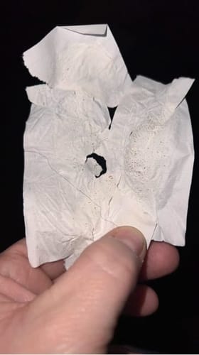 Customer photo review of Deep Cleansing Pore Strips