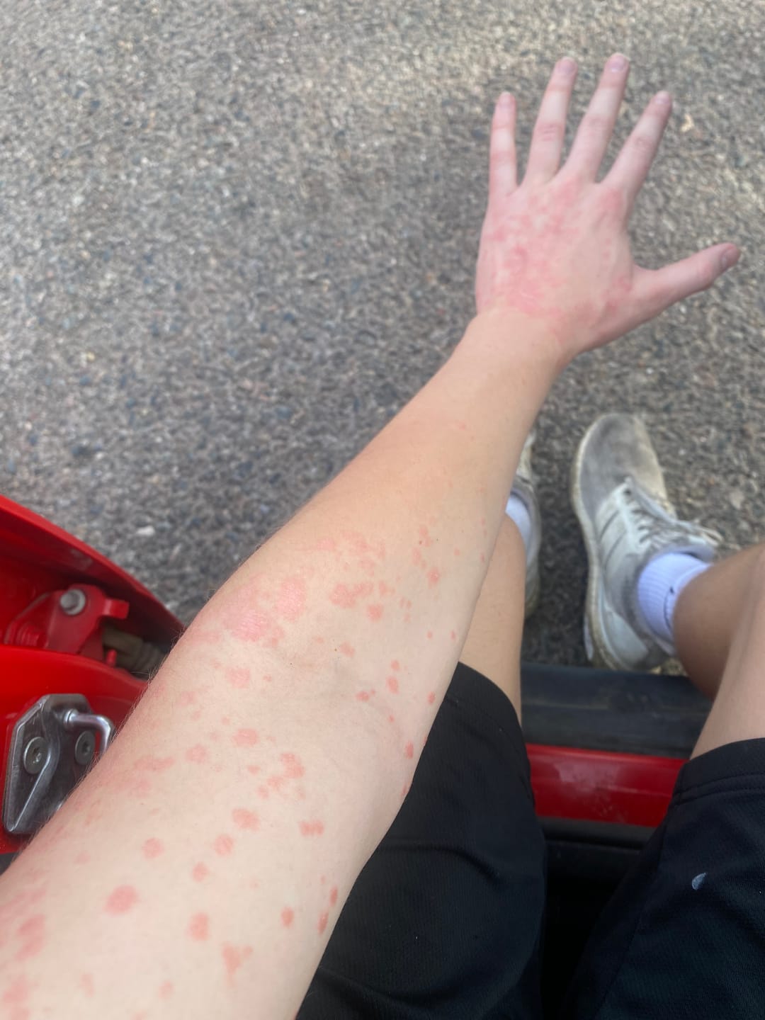 Customer photo review of HEALING HELPER | REGENERATIVE TALLOW CLOUD CREAM