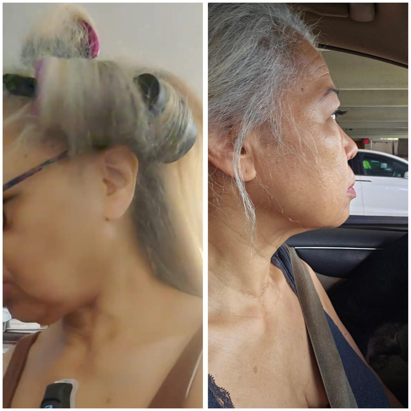 Customer photo review of Lumi Lyft