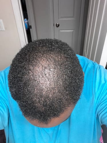 Customer photo review of Organic Hair Growth Oil