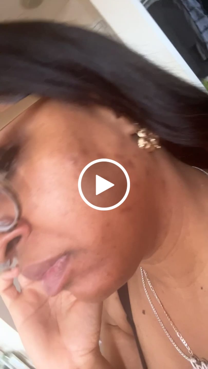 Customer video review of BERRI-CLEAR+ 5 BERRY SUPERFRUIT SERUM