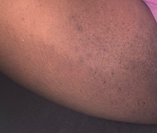 Customer photo review of Turmeric Glow Soap