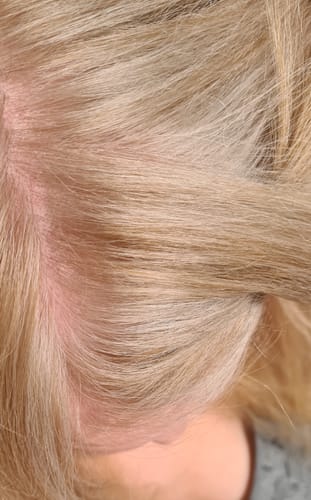 Customer photo review of Sunkissed Refill 3-pack