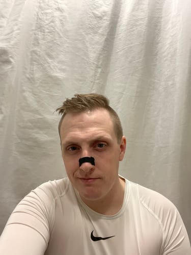 Customer photo review of Black Nasal Strips