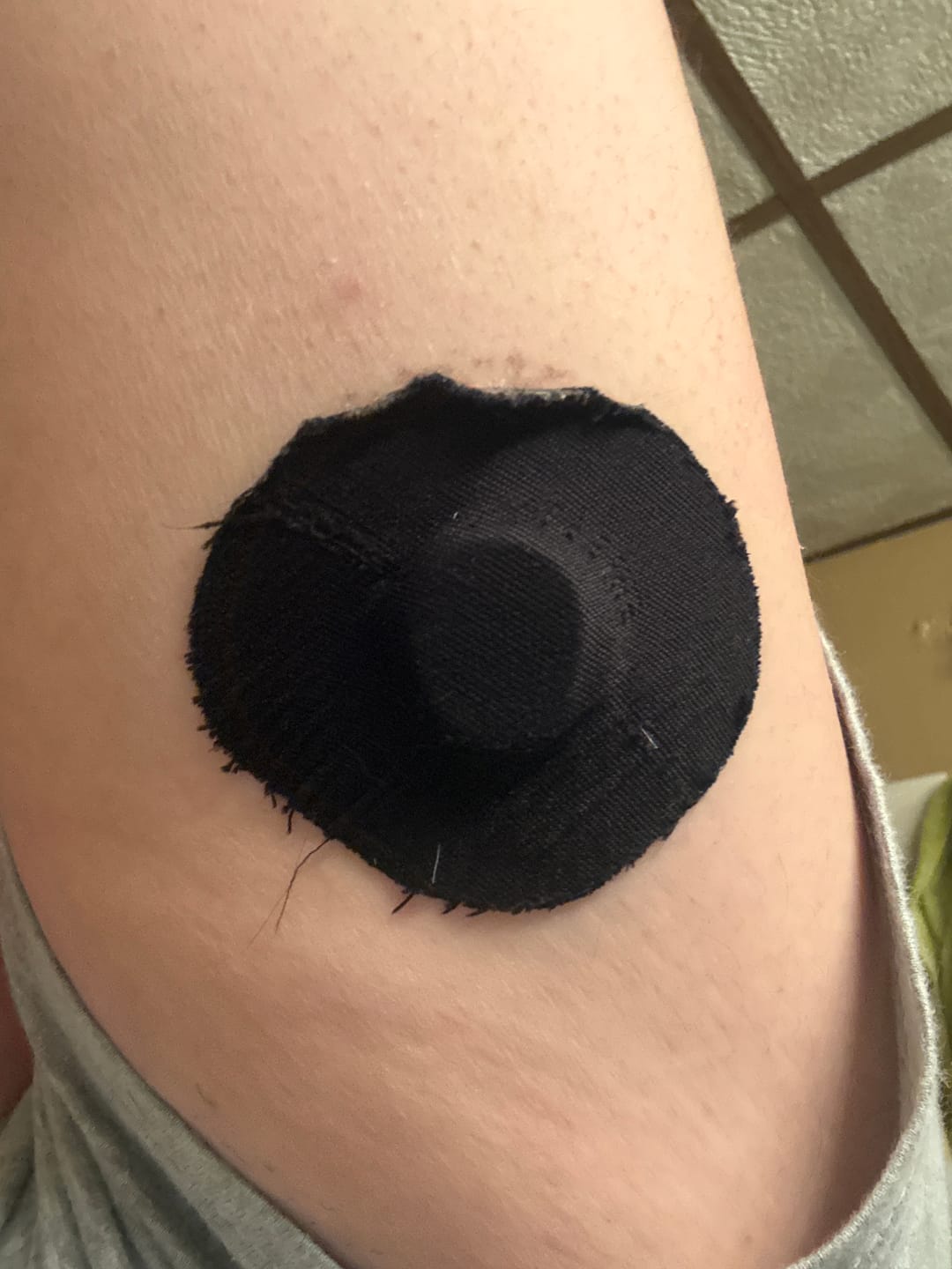 Customer photo review of Skin Grip Original - Dexcom G7 & Stelo Adhesive Patches
