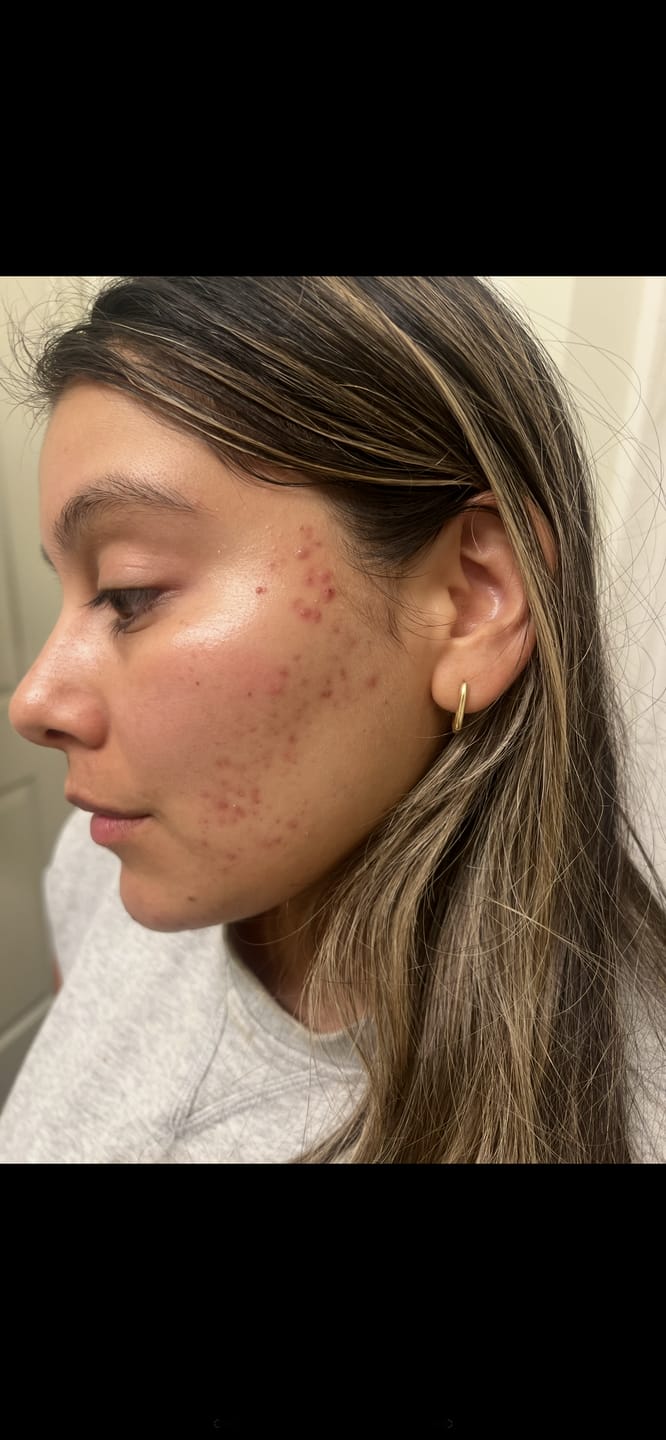 Customer photo review of Rose Propolis Facial Toner