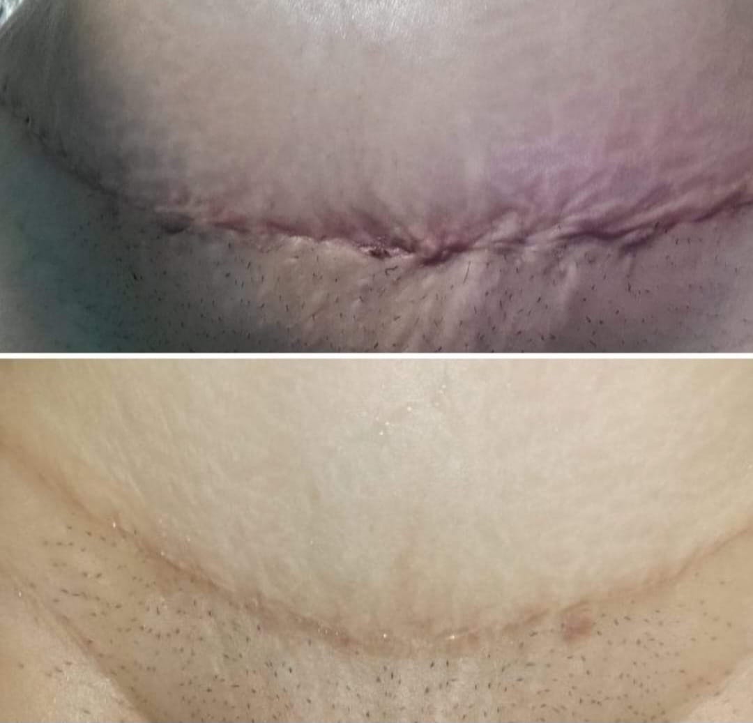 Customer photo review of Canibalm  High ointment