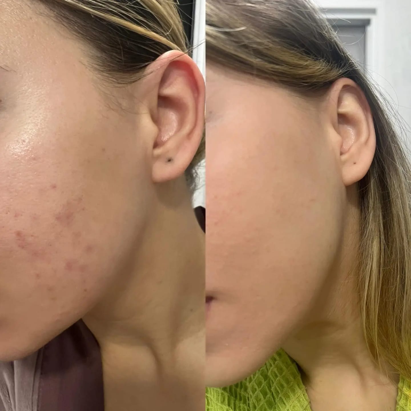 Customer photo review of Timeless+ | Anti-age крем с екзозоми