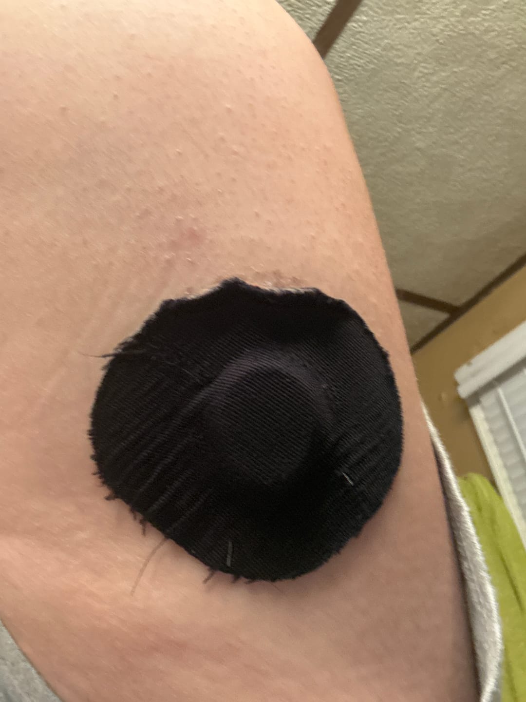 Customer photo review of Skin Defender Reusable Non-Adhesive Barrier - 5 Pack