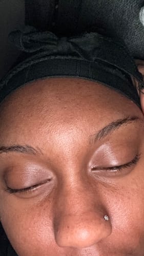 Customer photo review of LIMITED EDITION: Jolie’s Mini Full Body & Face Brightening Kit/ Acne Kit
