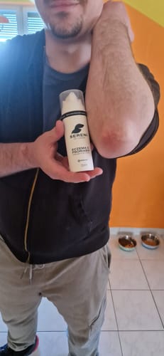 Customer photo review of Sereni Pikkelysömör és Ekcéma Krém