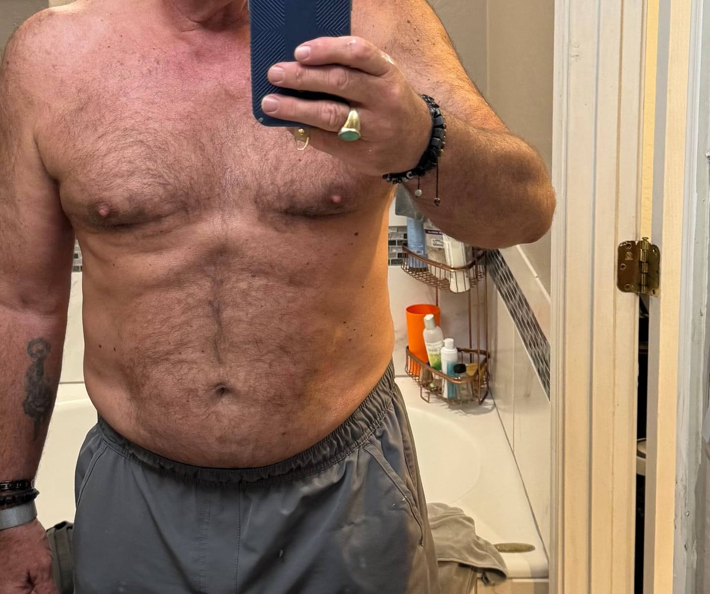 Customer photo review of Professional PERFECT SHAPE® NEO Body Sculpting Machine 5 in 1