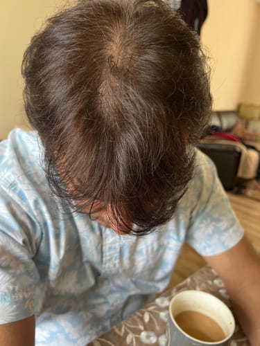 Customer photo review of Collagen 3 Month Supply (750g)