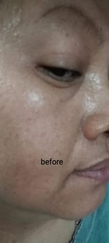 Customer photo review of Radiance: Gold Radiance Serum [Limited Edition]