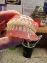 Customer photo review of HZA™ --🦷Advanced Customized Full Denture Set🦷 (⏰Limited time discount last 30 minutes⏰)
