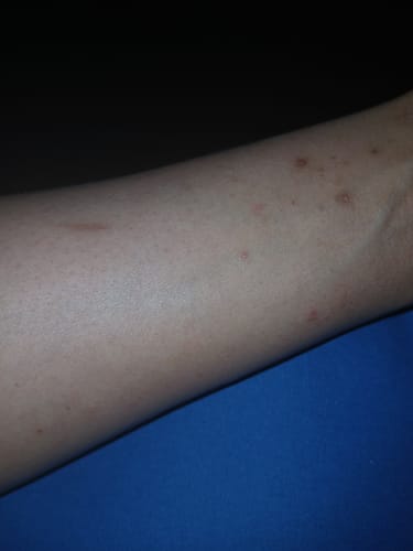 Customer photo review of Turmeric Glow Soap