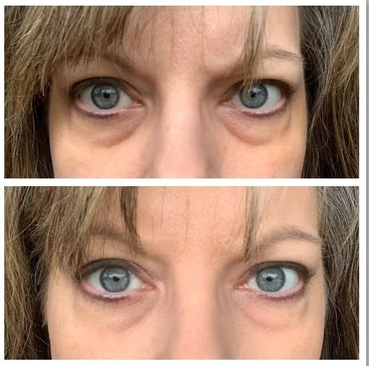 Customer photo review of Brightening Eye Cream