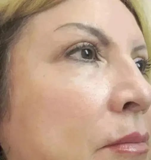 Customer photo review of Brightening Eye Cream