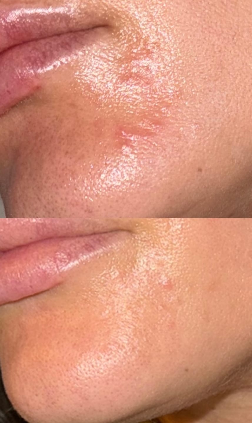 Customer photo review of Sébula+ | Липиден серум със сквалан