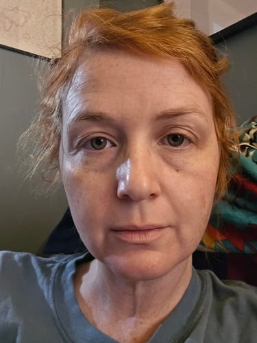 Customer photo review of Glov Micro Infusion System