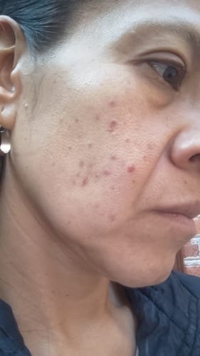 Customer photo review of Formula Personalizada (Rx)