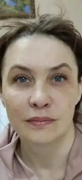 Customer photo review of Anti-Age Day Cream