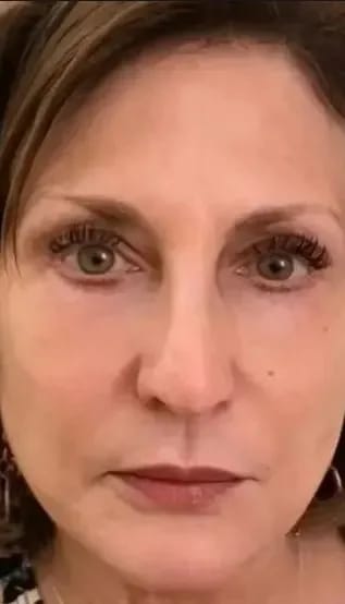 Customer photo review of Brightening Eye Cream