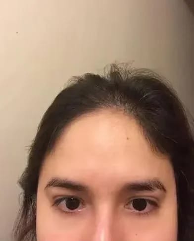 Customer photo review of Brightening Eye Cream