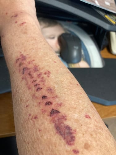 Customer photo review of Grass Fed Tallow & Honey Balm