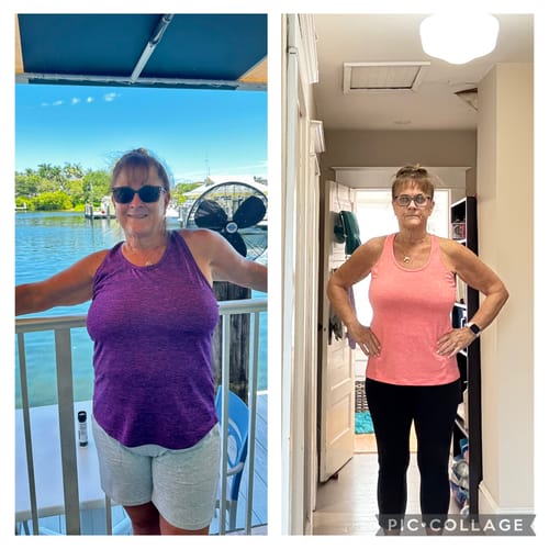 Customer photo review of Semaglutide Weight Loss Program Three Months