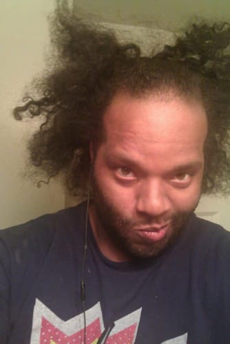 Customer photo review of Four Bottles of Rennora Hair Growth Serum