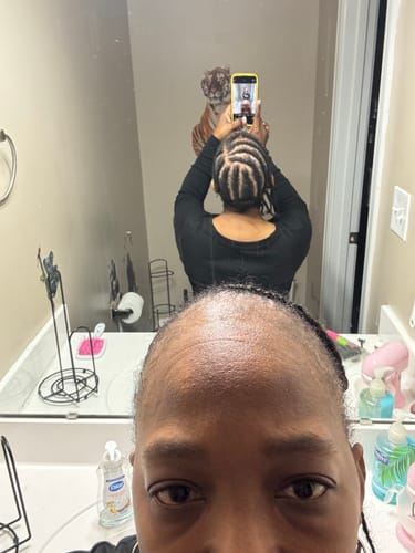 Customer photo review of Rennora Regrowth Shampoo and Conditioner Set