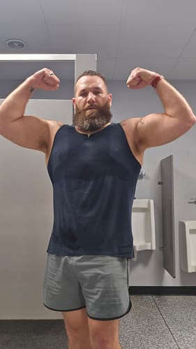 Customer photo review of Tirzepatide Weight Loss Program