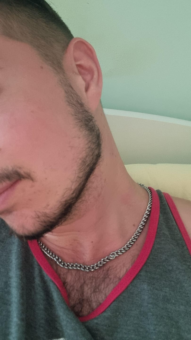 Customer photo review of Dermaroller Barbe Beard-Roller Stimulation Naturelle de la Pousse