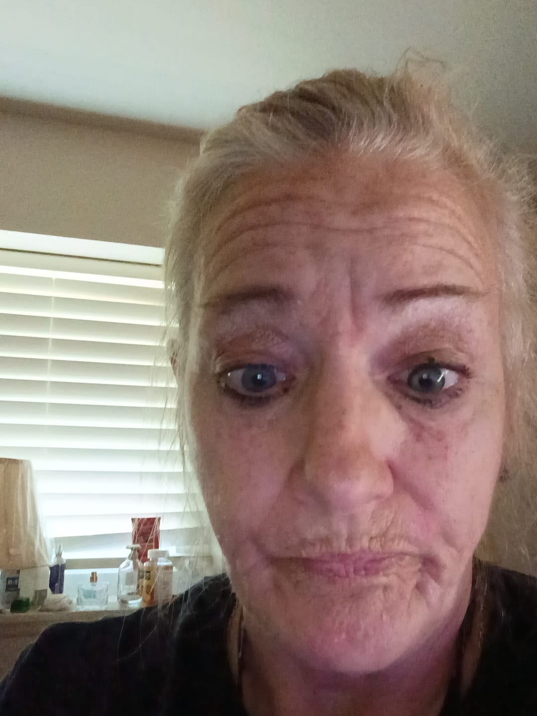 Customer photo review of Amaretto Blue Prescription Colored Contact Lenses