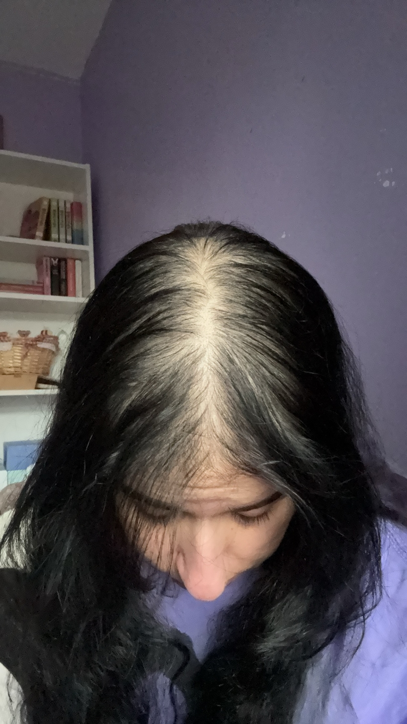 Huma A. before