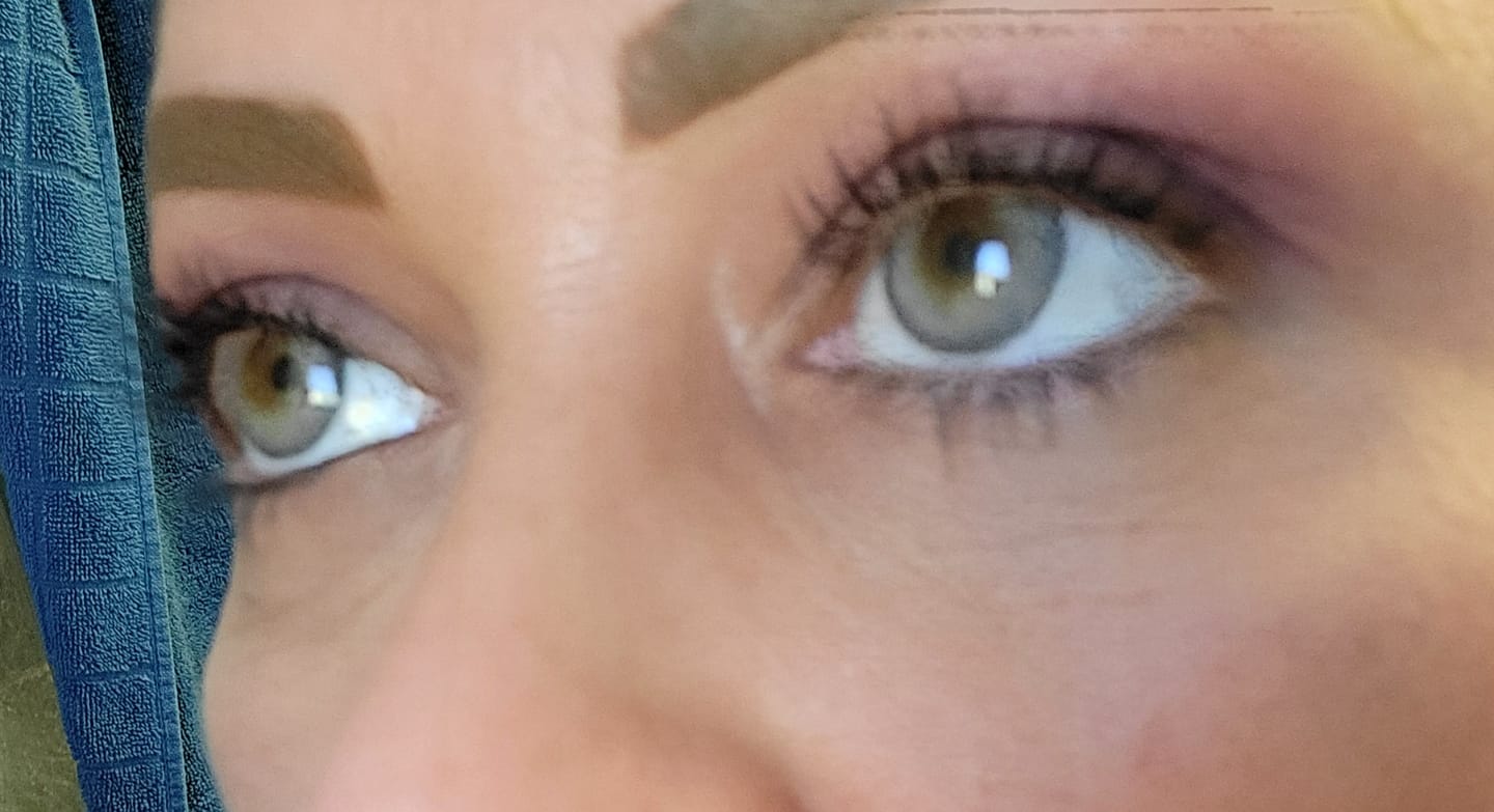 Customer photo review of Premium Candy Gray Prescription Colored Contact Lenses