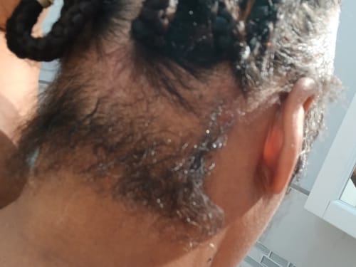 Customer photo review of Herbal Hair Growth Oil