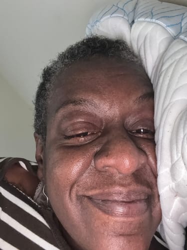 Customer photo review of Rennora Hair Growth Serum