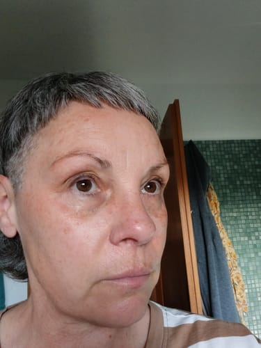 Customer photo review of Skin Refining Trio