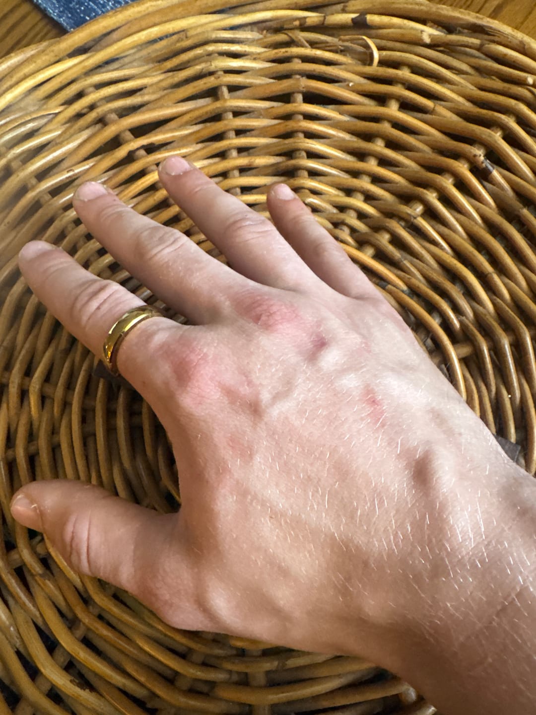 Customer photo review of iTap Ring