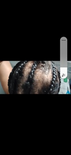 Customer photo review of Mini Herbal Hair Growth Oil