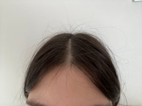 Customer photo review of Kit para Crecimiento del Cabello