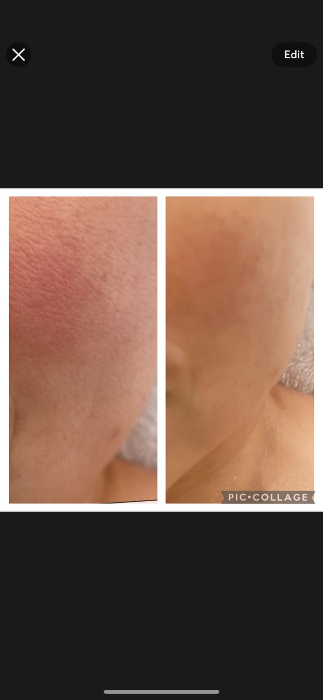 Customer photo review of Velo de Seda de Péptido Mascarilla Facial  100% Natural -  Alto Nivel de Hidratación y Nutrición