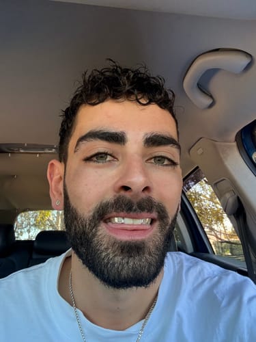Customer photo review of SPARK (SILVER GRILLZ)