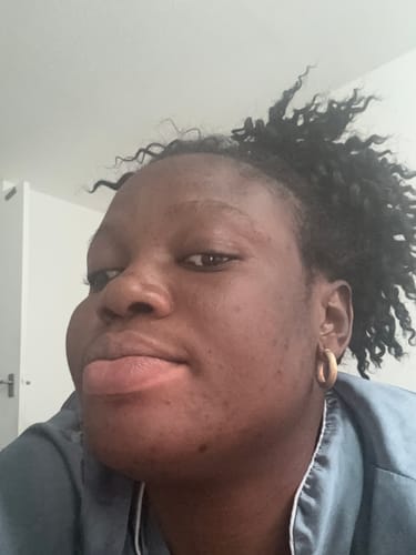 Customer photo review of Turmeric Glow Soap