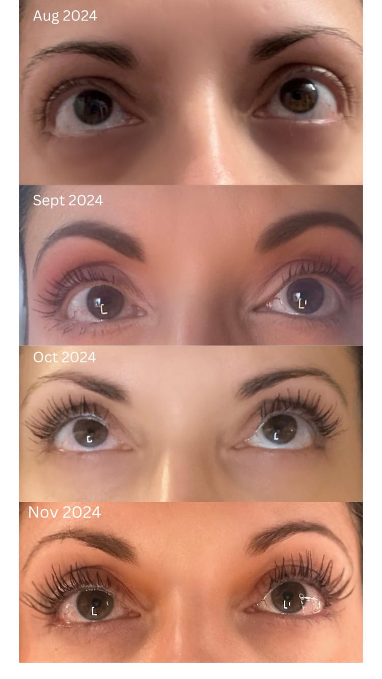 Customer photo review of EYELASH GROWTH SOLUTION