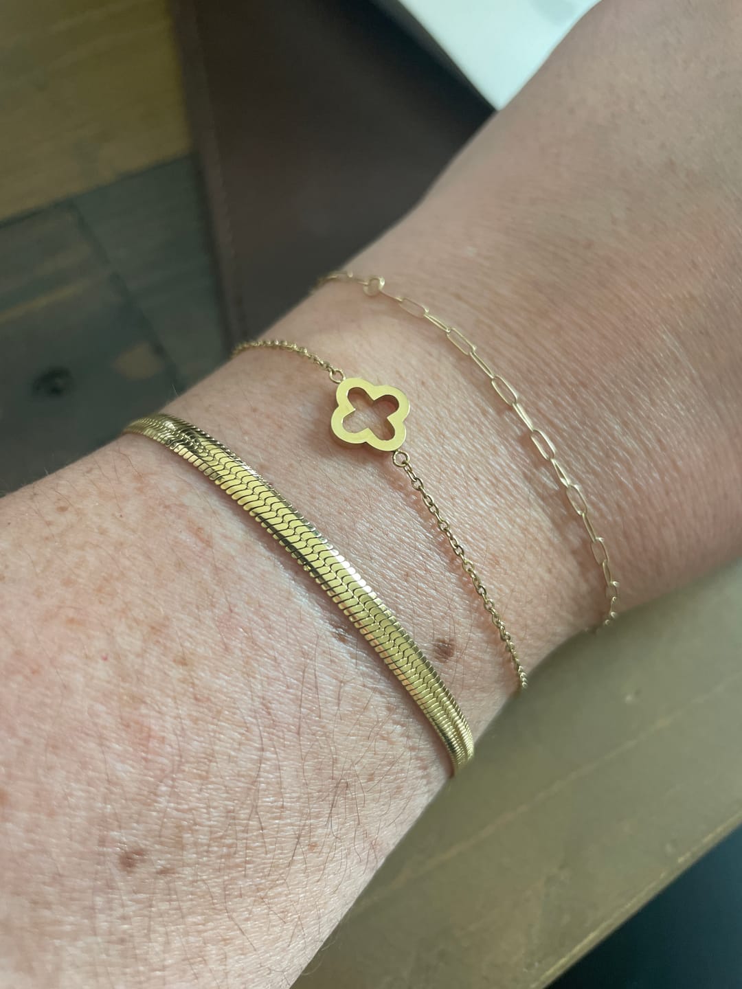 Customer photo review of Essentials Bracelet