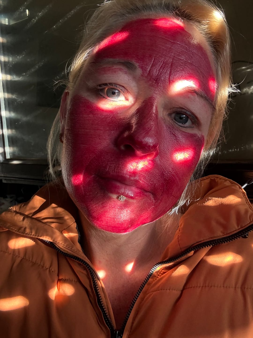 Customer photo review of VAMPIRE PEEL® - Fruchtsäurepeeling
