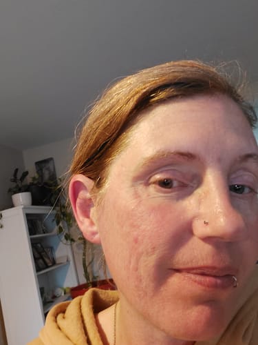 Customer photo review of F-Balm - Premium Anti-aging Tallow Balm 2 oz. Tin